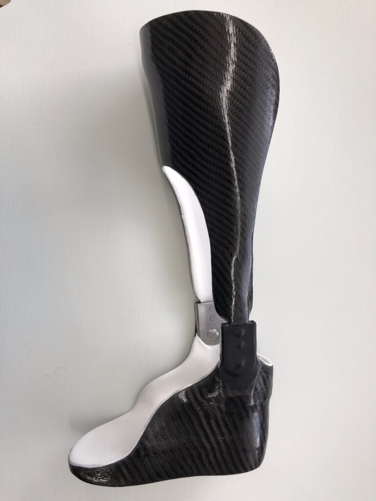 Seitenansicht einer modernen Unterschenkelorthese aus Carbon und weißem Kunststoff, mit Gelenk im Knöchelbereich